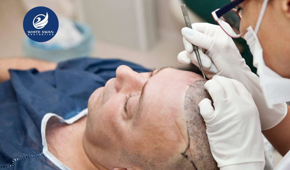 Hair Transplantation Near Me