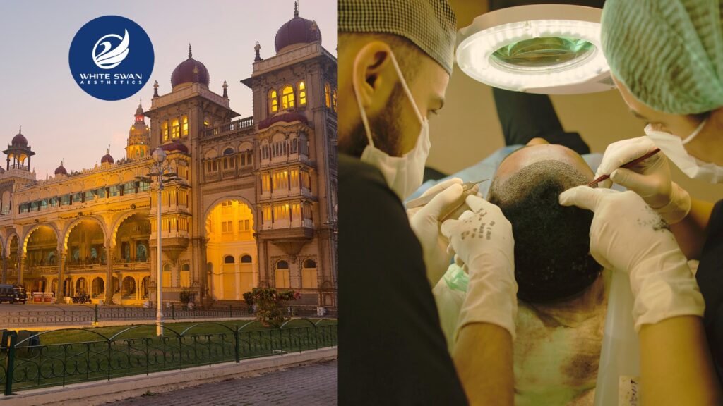 hair transplant clinic in Mysore