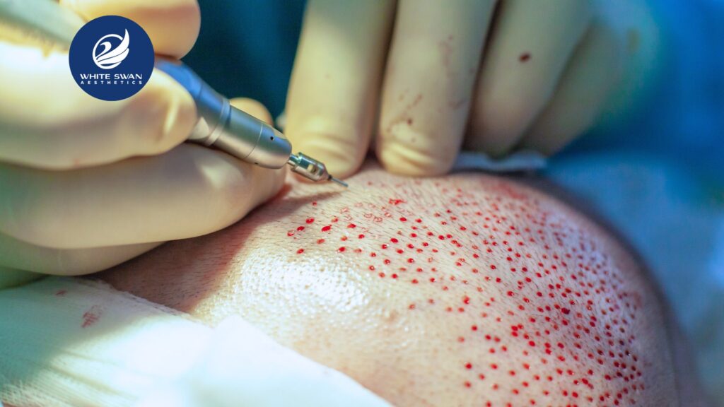 Hair Transplant Centre