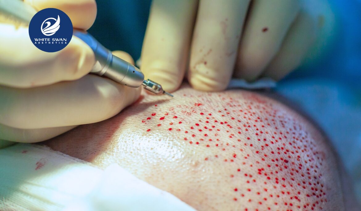 Hair Transplant Centre