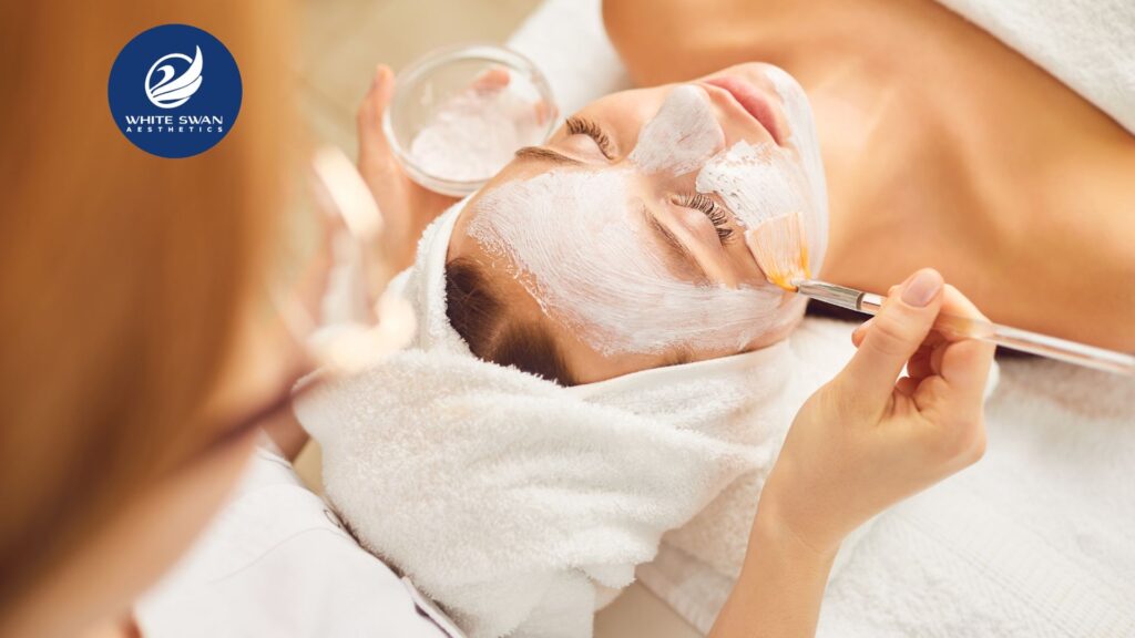 TCA Chemical Peel