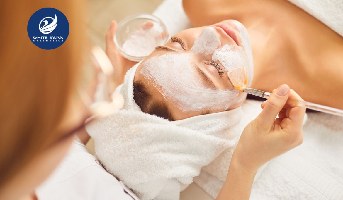 TCA Chemical Peel