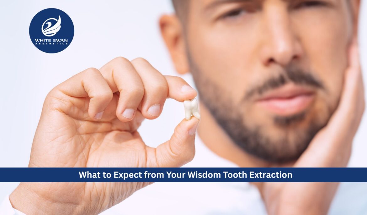 wisdom tooth extraction