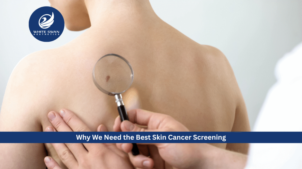 Skin cancer screening