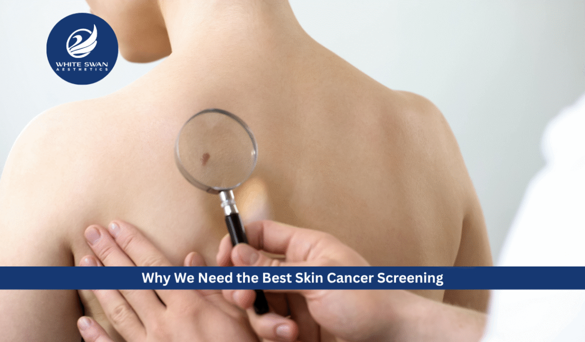 Skin cancer screening