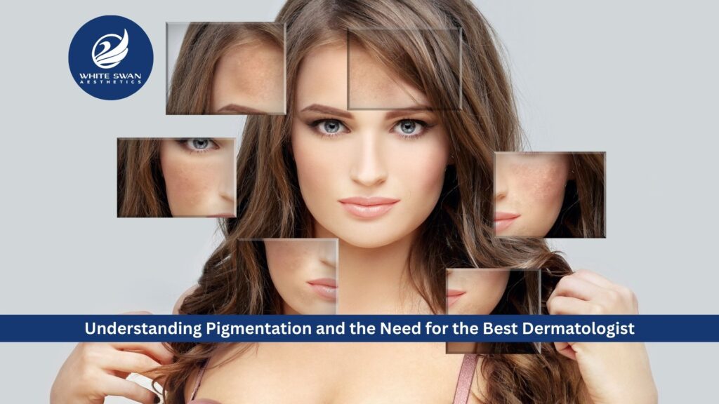 Understanding Pigmentation and the Need for the Best Dermatologist