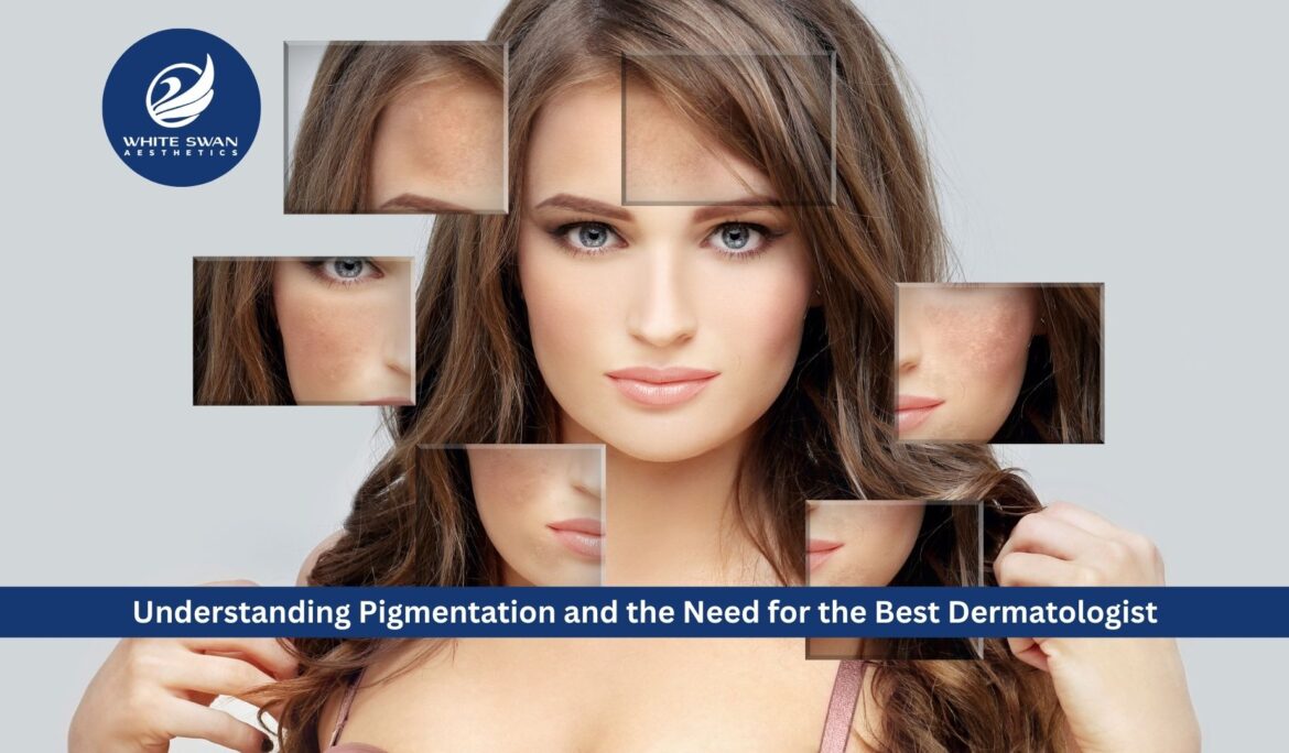 Understanding Pigmentation and the Need for the Best Dermatologist