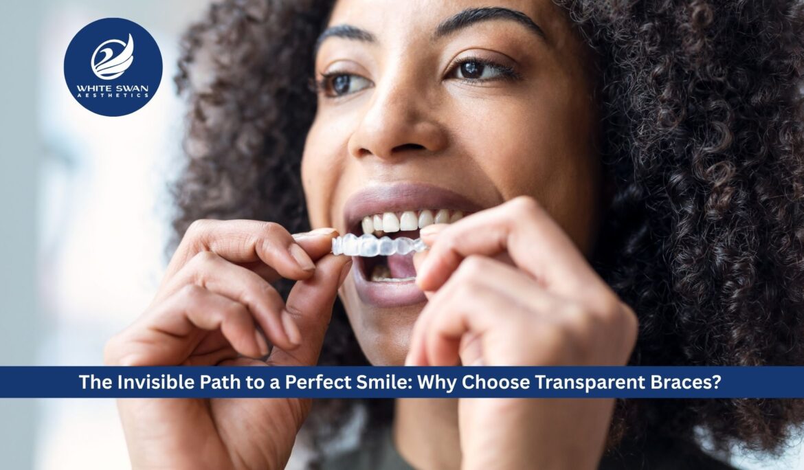The Invisible Path to a Perfect Smile: Why Choose Transparent Braces?
