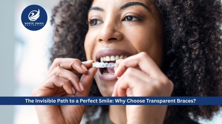 The Invisible Path to a Perfect Smile: Why Choose Transparent Braces?