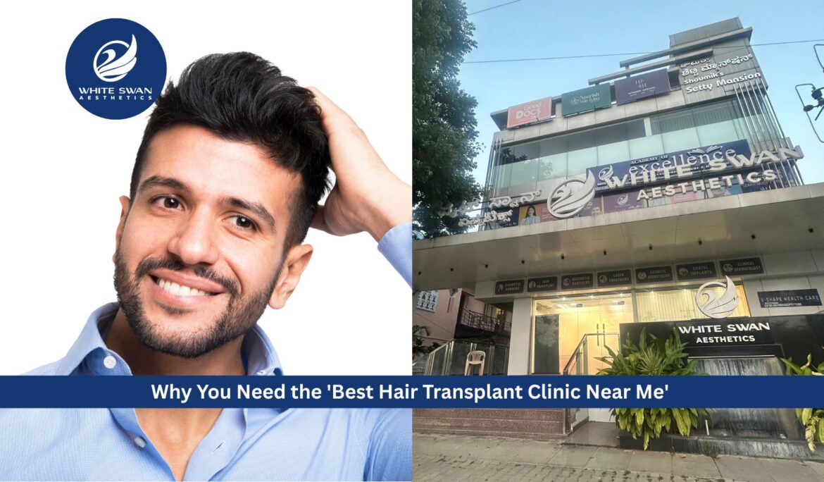 Best Hair Transplant Clinic Near Me