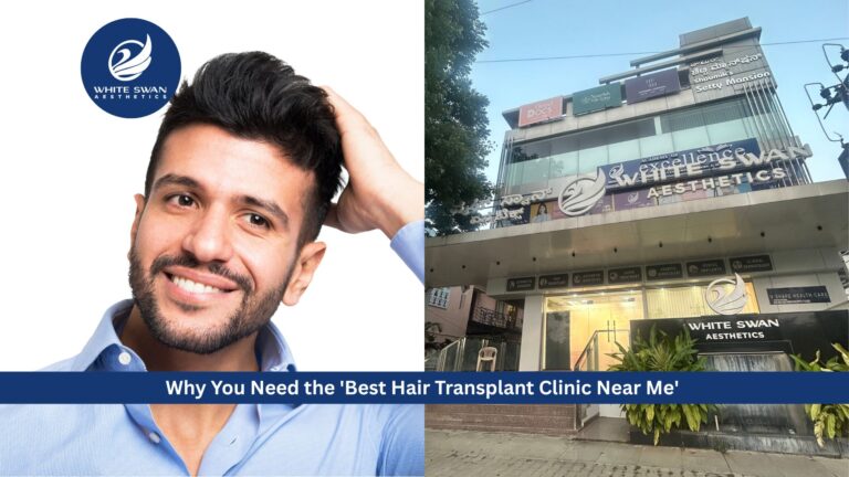 Best Hair Transplant Clinic Near Me