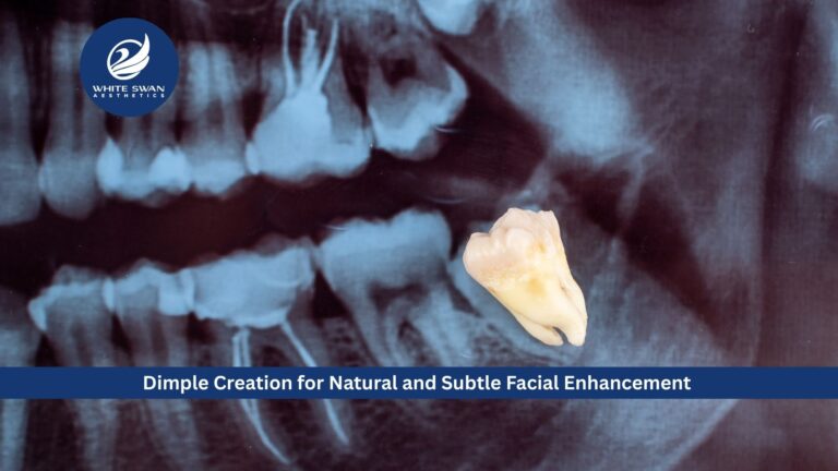 Wisdom Tooth Extraction: Preventing Pain and Oral Complications