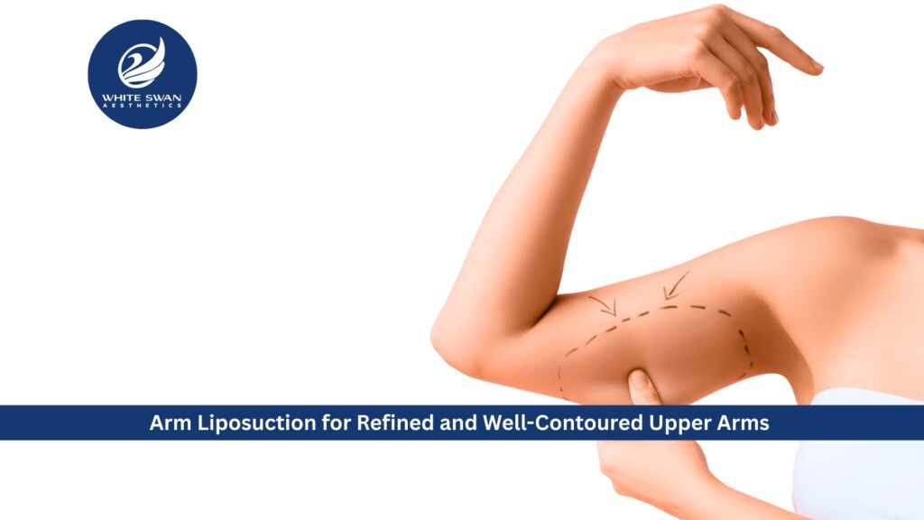 Arm Liposuction for Refined and Well-Contoured Upper Arms