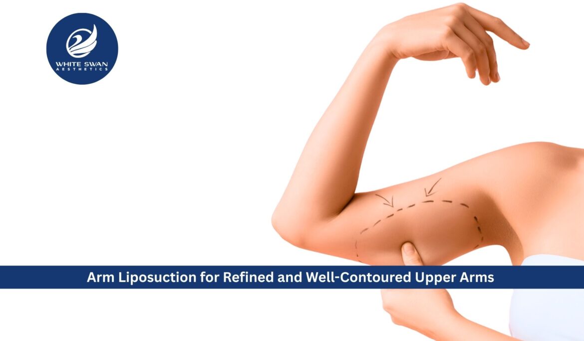 Arm Liposuction for Refined and Well-Contoured Upper Arms