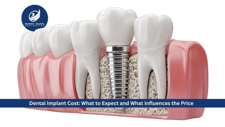 Dental Implant Cost: What to Expect and What Influences the Price