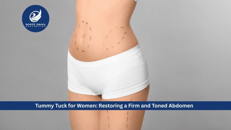 Tummy Tuck for Women: Restoring a Firm and Toned Abdomen