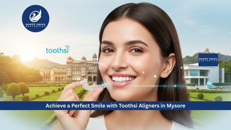 Achieve a Perfect Smile with Toothsi Aligners in Mysore
