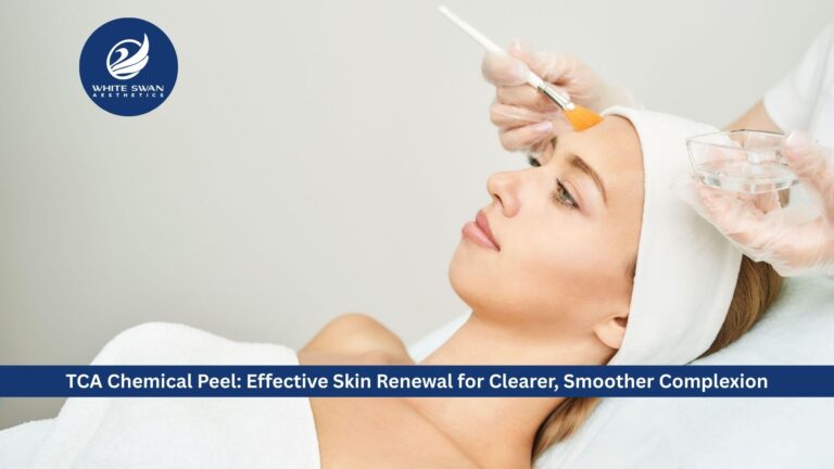 TCA Chemical Peel: Effective Skin Renewal for Clearer, Smoother Complexion