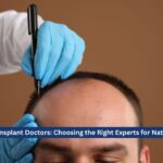 Top Hair Transplant Doctors: Choosing the Right Experts for Natural Results