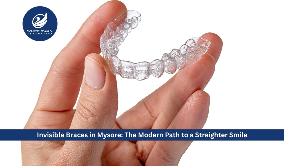 Invisible Braces in Mysore: The Modern Path to a Straighter Smile