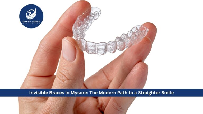Invisible Braces in Mysore: The Modern Path to a Straighter Smile