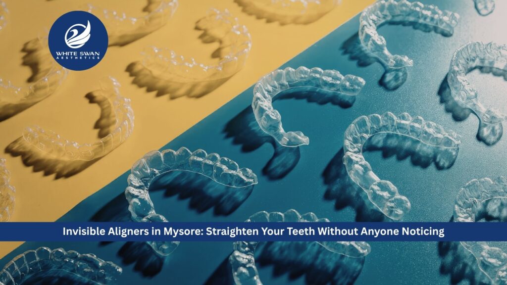 Invisible Aligners in Mysore: Straighten Your Teeth Without Anyone Noticing