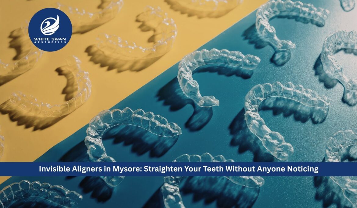 Invisible Aligners in Mysore: Straighten Your Teeth Without Anyone Noticing
