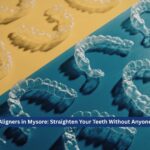 Invisible Aligners in Mysore: Straighten Your Teeth Without Anyone Noticing