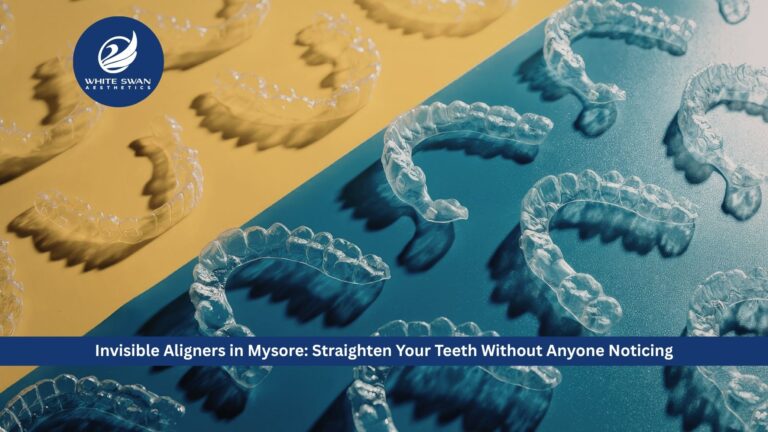 Invisible Aligners in Mysore: Straighten Your Teeth Without Anyone Noticing