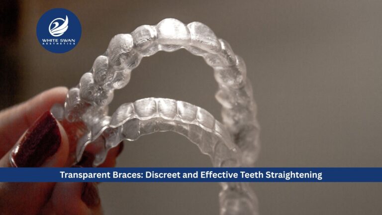 Transparent Braces: Discreet and Effective Teeth Straightening