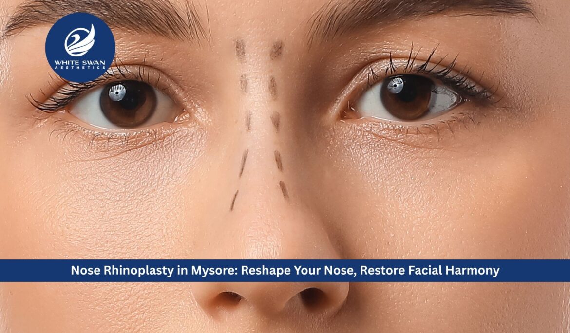 Nose Rhinoplasty in Mysore: Reshape Your Nose, Restore Facial Harmony