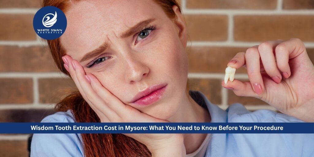 Wisdom Tooth Extraction Cost in Mysore: What You Need to Know Before Your Procedure