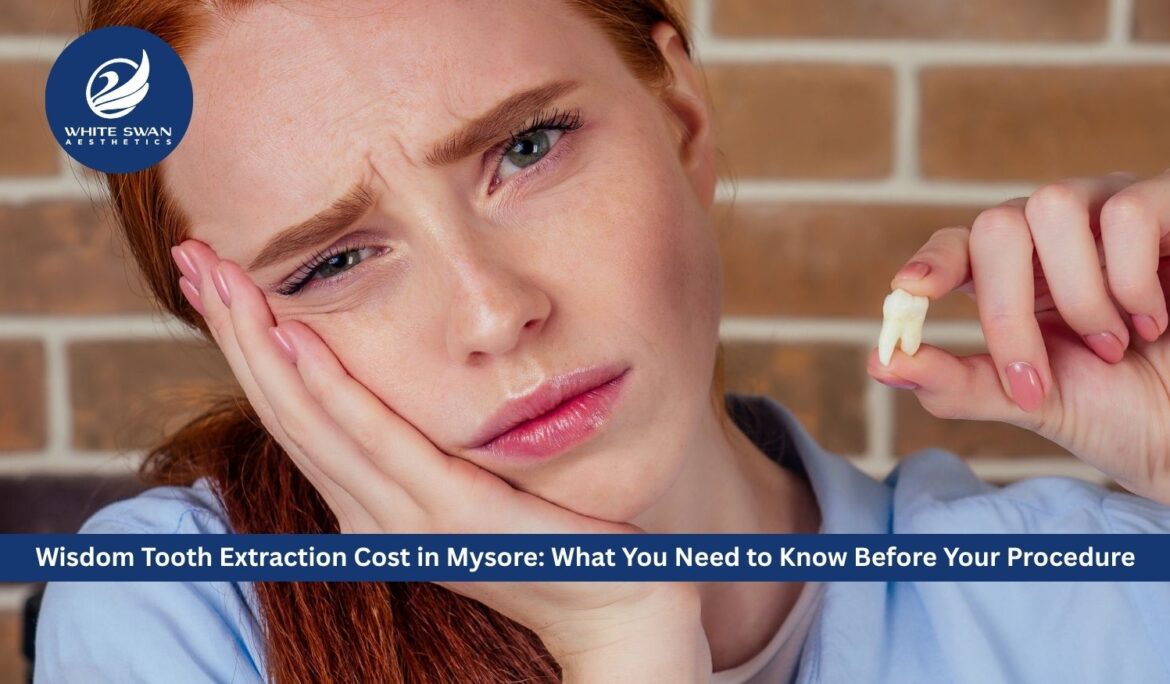 Wisdom Tooth Extraction Cost in Mysore: What You Need to Know Before Your Procedure