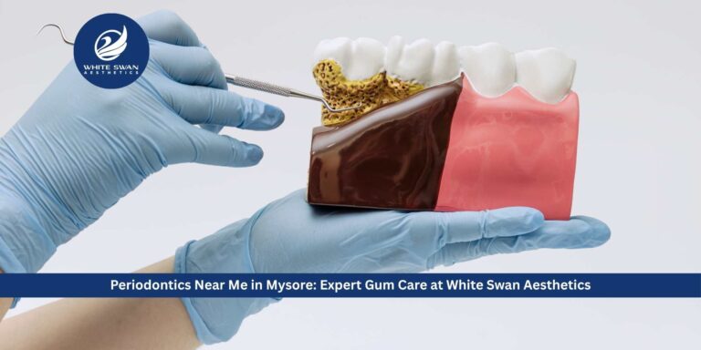 Periodontics Near Me in Mysore: Expert Gum Care at White Swan Aesthetics