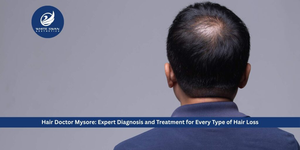 Hair Doctor Mysore: Expert Diagnosis and Treatment for Every Type of Hair Loss