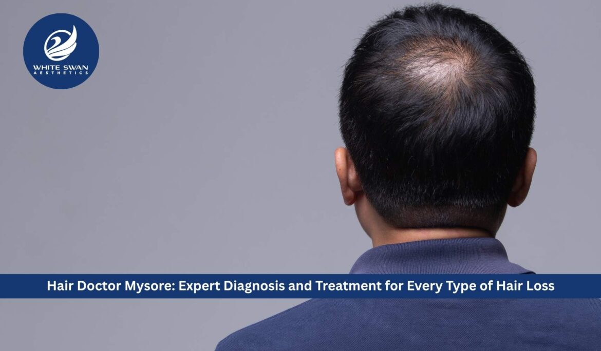 Hair Doctor Mysore: Expert Diagnosis and Treatment for Every Type of Hair Loss