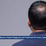 Hair Doctor Mysore: Expert Diagnosis and Treatment for Every Type of Hair Loss
