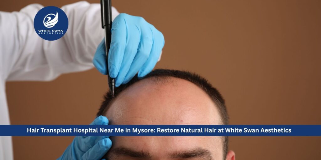 Hair Transplant Hospital Near Me in Mysore: Restore Natural Hair at White Swan Aesthetics