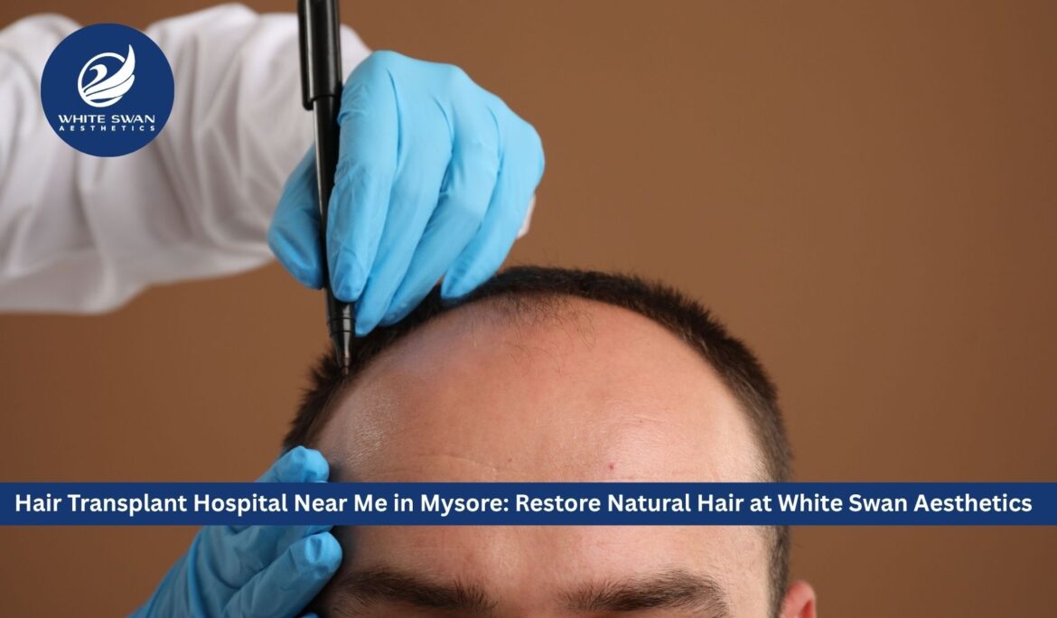 Hair Transplant Hospital Near Me in Mysore: Restore Natural Hair at White Swan Aesthetics