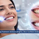 Teeth Whitening Treatment: Achieve a Brighter, More Confident Smile Professionally