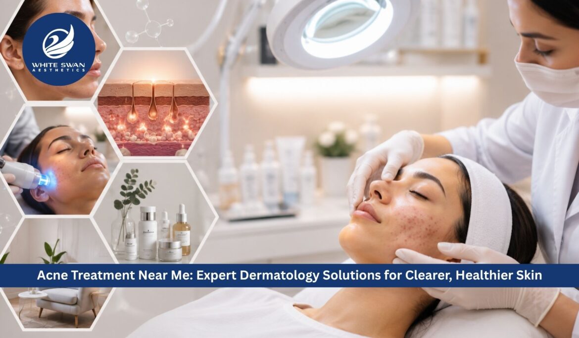Acne Treatment Near Me: Expert Dermatology Solutions for Clearer, Healthier Skin